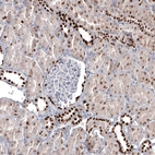 Immunohistochemical staining of human kidney shows strong nuclear positivity in cells in distal tubules.