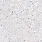 Immunohistochemical staining of human hypothalamus shows moderate to strong nuclear positivity in a subset of neurons.