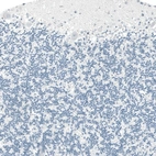Immunohistochemical staining of human cerebellum shows no positivity in Purkinje cells as expected.