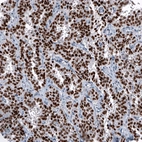 Anti-OTP Recombinant Antibody