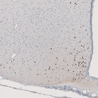 Immunohistochemical staining of rat hypothalamus shows strong nuclear positivity in a subset of neurons.