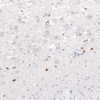 Immunohistochemical staining of human hypothalamus shows strong nuclear positivity in a subset of neurons.
