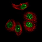 Immunofluorescence staining of MCF7 cells using the Anti-OTP monoclonal antibody, showing specific staining in nuclear bodies and in the nucleoplasm in green. Microtubule and nuclear probes are visualized in red and blue, respectively.