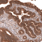 Immunohistochemical staining of human fallopian tube shows strong cytoplasmic positivity in glandular cells.