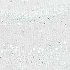 Immunohistochemical staining of rat hippocampus shows no positivity in neurons in the dentate gyrus as expected.