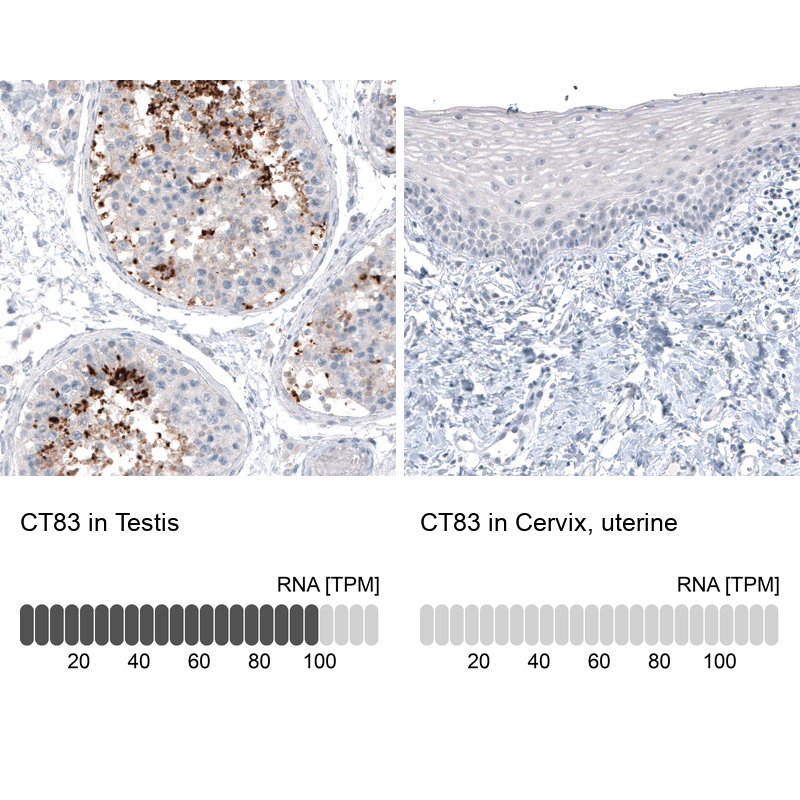Anti-CT83 Recombinant Antibody