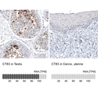 Anti-CT83 Recombinant Antibody