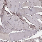 Immunohistochemical staining of human skeletal muscle shows no positivity in myocytes.