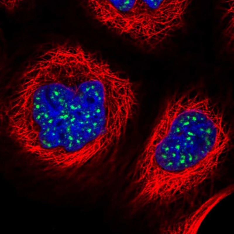 Anti-ZNF695 Antibody