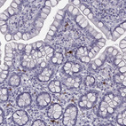 Immunohistochemical staining of human small intestine shows moderate to strong cytoplasmic positivity in lymphoid cells.