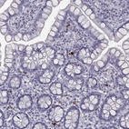 Immunohistochemical staining of human small intestine shows moderate to strong cytoplasmic positivity in lymphoid cells.