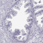 Immunohistochemical staining of human prostate shows no positivity in glandular cells as expected.