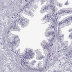 Immunohistochemical staining of human prostate shows no positivity in glandular cells as expected.