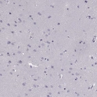 Immunohistochemical staining of human cerebral cortex shows no positivity in neurons as expected.