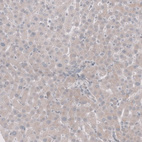 Immunohistochemical staining of human liver shows no cytoplasmic positivity in hepatocytes as expected.
