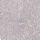 Immunohistochemical staining of human liver shows no cytoplasmic positivity in hepatocytes as expected.