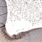 Immunohistochemical staining of e11 mouse embryo brain shows moderate nuclear positivity in neurons.