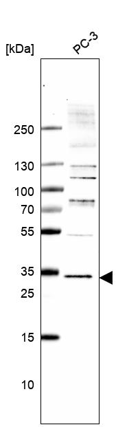 Anti-TMEM255B Antibody