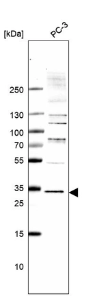 Anti-TMEM255B Antibody