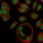 Anti-ZNF629 Antibody