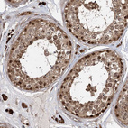 Immunohistochemical staining of human testis shows strong nuclear and cytoplasmic positivity in cells in seminiferous ducts.