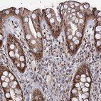 Immunohistochemical staining of human rectum shows strong nuclear and cytoplasmic positivity in glandular cells and lymphoid cells.