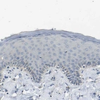 Immunohistochemical staining of human skin shows no positivity in squamous epithelial cells as expected.