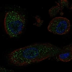 Immunofluorescent staining of human cell line RPTEC TERT1 shows localization to vesicles.