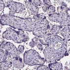 Immunohistochemical staining of human placenta shows no positivity in trophoblastic cells as expected.