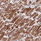 Immunohistochemical staining of human heart muscle shows moderate cytoplasmic positivity in cardiomyocytes.