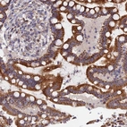 Immunohistochemical staining of human colon shows strong cytoplasmic granular positivity in glandular cells.