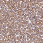 Immunohistochemical staining of human liver shows moderate cytoplasmic positivity in hepatocytes.