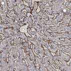 Immunohistochemical staining of human liver shows strong membranous positivity in endothelial cells.