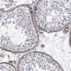 Immunohistochemical staining of human testis shows moderate membranous positivity in peritubular myoid cells.