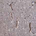 Immunohistochemical staining of human cerebellum shows strong membranous positivity in endothelial cells.