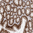 Immunohistochemical staining of human stomach shows strong cytoplasmic-membranous positivity in glandular cells.