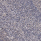 Immunohistochemical staining of human tonsil tissue shows no positivity in non-germinal center cells.