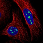 Immunofluorescent staining of human cell line U-2 OS shows localization to nucleoli.