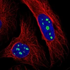 Immunofluorescent staining of human cell line U-2 OS shows localization to nucleoli.