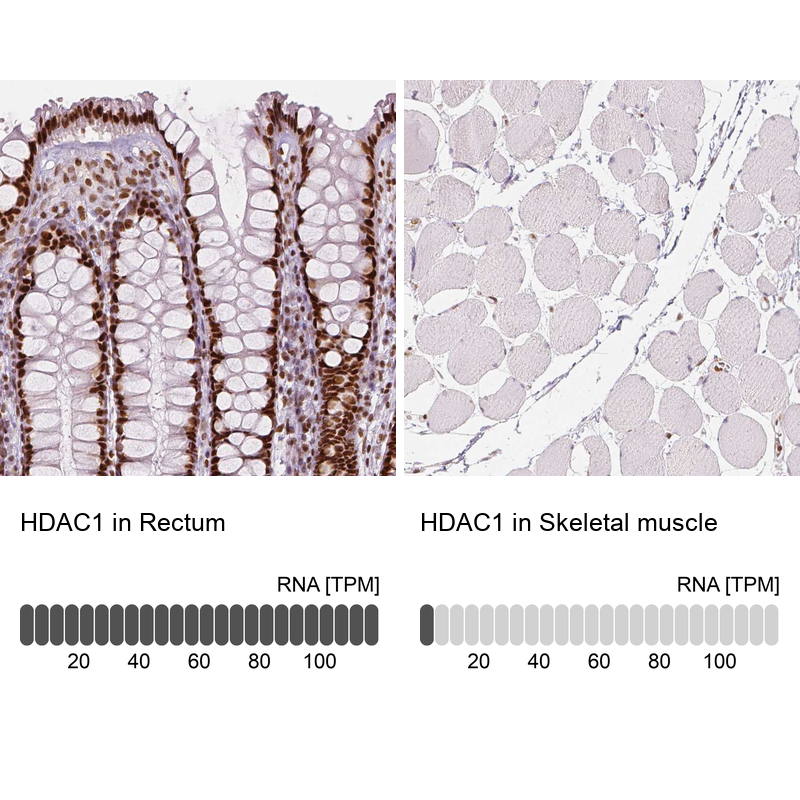 Anti-HDAC1 Recombinant Antibody
