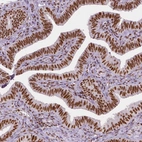 Immunohistochemical staining of human fallopian tube shows strong nuclear positivity in glandular cells.