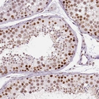 Immunohistochemical staining of human testis shows moderate to strong nuclear positivity in cells in seminiferous ducts.