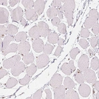 Immunohistochemical staining of human skeletal muscle shows no positivity in myocytes as expected.