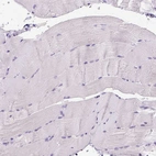 Immunohistochemical staining of human skeletal muscle shows no positivity in striated muscle fibers as expected.