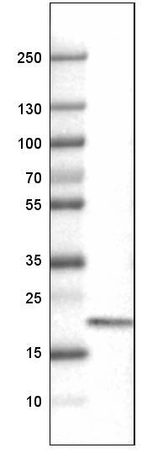 Lane 1: Marker [kDa]_br/_Lane 2: Human tonsil