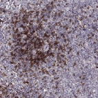 Immunohistochemical staining of human tonsil shows strong membranous positivity in non-germinal center cells.