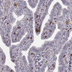 Immunohistochemical staining of human fallopian tube shows strong membranous positivity in lymphoid cells.