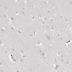 Immunohistochemical staining of human cerebral cortex shows no positivity in neurons as expected.