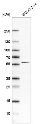 Western blot analysis in human cell line SCLC-21H.