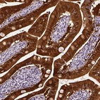 Immunohistochemical staining of human small intestine shows strong cytoplasmic positivity in glandular cells in additional to membranous positivity.